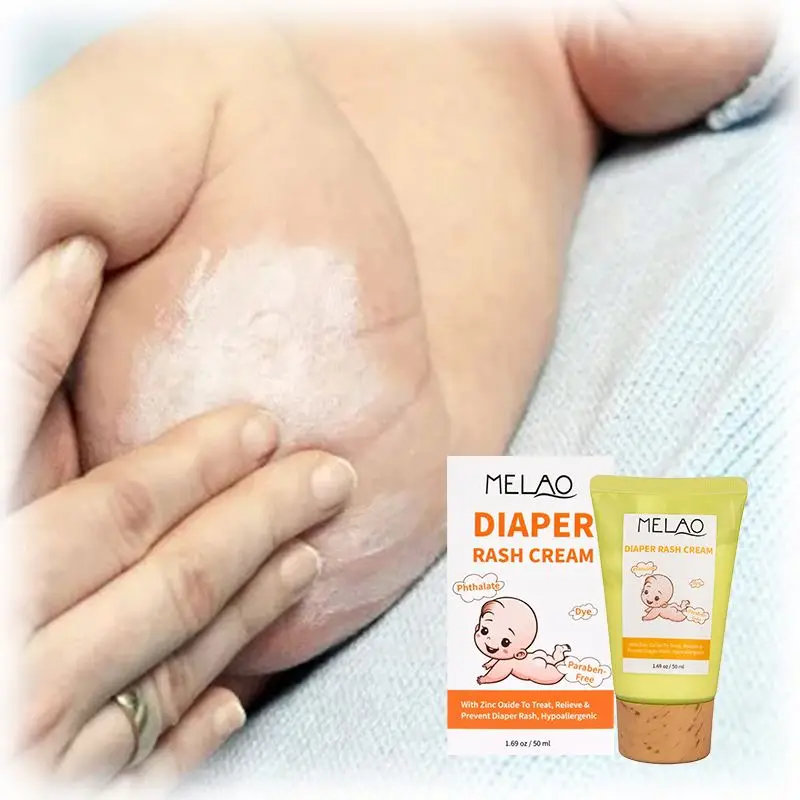 Wholesale Private Label Natural organic diaper rash cream for Moisturizing Smoothing baby skin care