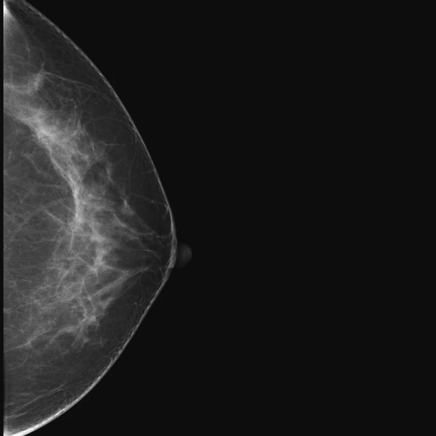 Careview 750M mammography flat panel detector price