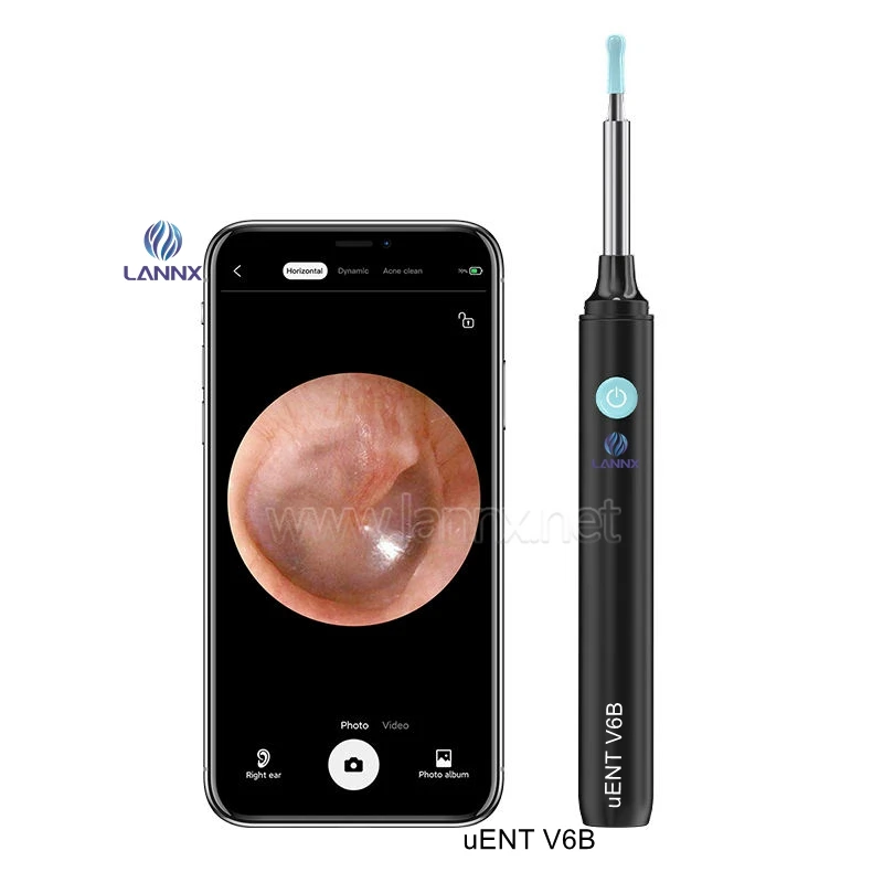 LANNX uENT V6B Hot Sell Charging Earpick Cleaner Spoon earpick Tool Ear wax Remover with Led light wireless Visual Ear Cleaner