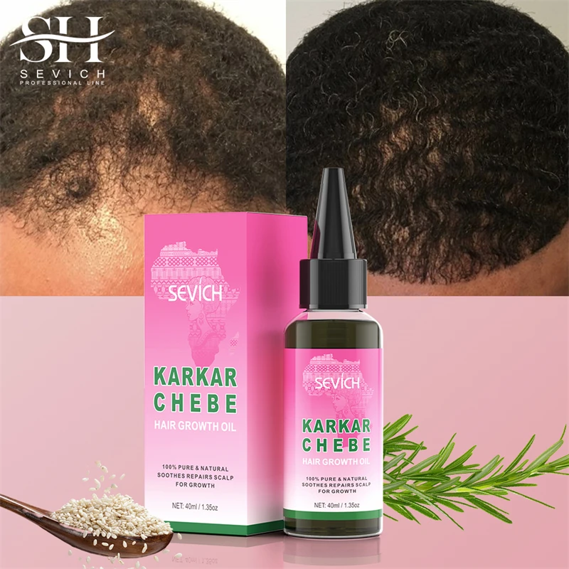 Best Hair Growth Rosemary Oil Veganic Natural Thickening Repairing Nourishing Chebe Oil for Hair Product