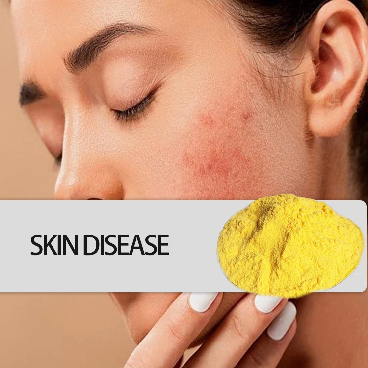 factory manufacturers supply hcl powder mono metabolism price for hcl vitamin b1 thiamine mononitrate