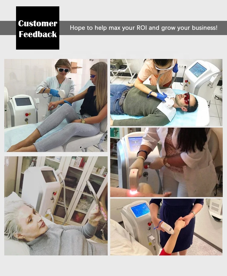 2022 CE approved diode laser hair removal system 755 808 1064nm for hair removal free training 3 years warranty