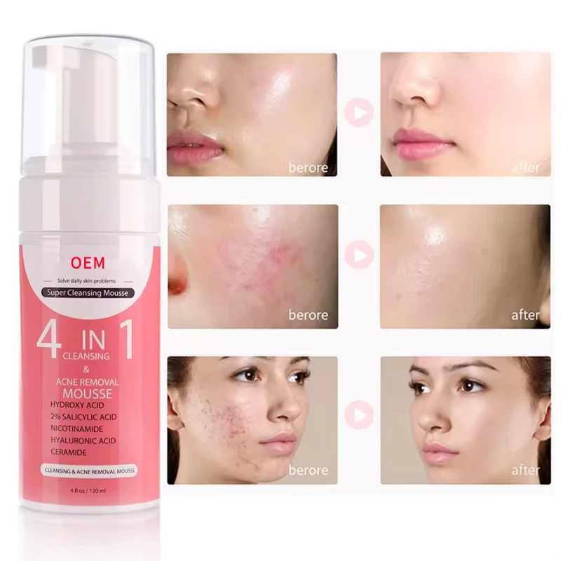Face Wash Facial Cleanser for Sensitive Skin Makeup Removing Amino Acid Cleansing Mousse Hydrating Amino Acid Facial Cleanser
