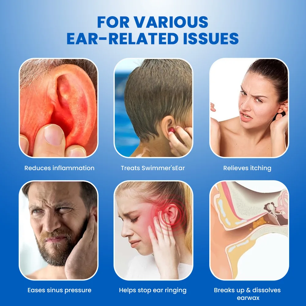 20ml Ear Tinnitus Ringing help Relieving Ear Drops Deafness Ear Swelling Discharge Otitis Media Fluid For Health Care