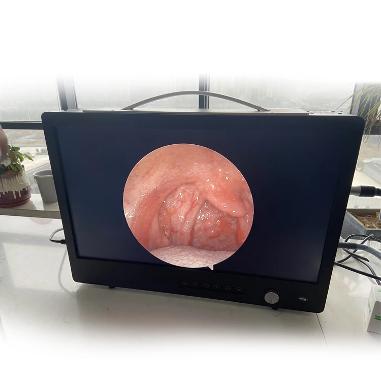 Portable 22 Inch Full Hd 1080p Endoscopic Camera With Recording Function