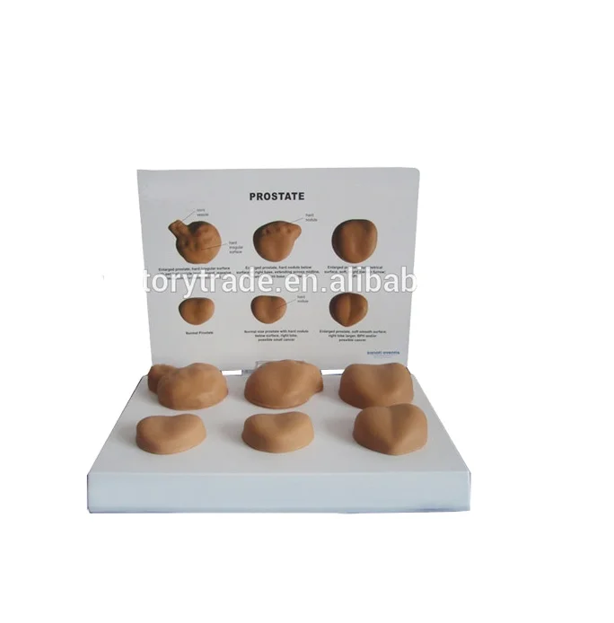 V-AM028 Wholesale human male anatomical pathological prostate model