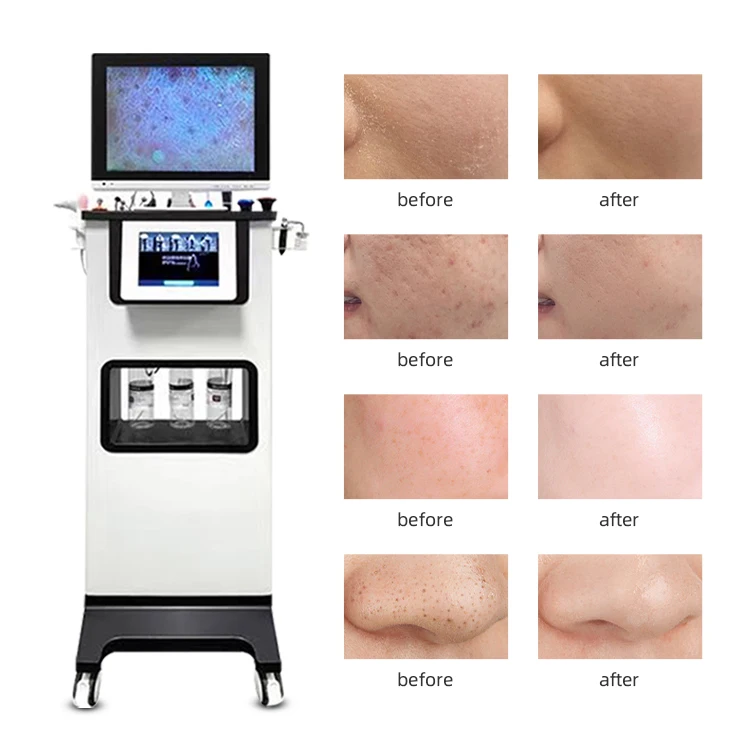2024 Beauty Spa skin Repair care deep cleaning 11in1 Water dermabrasion facial Microdermabrasion Machine