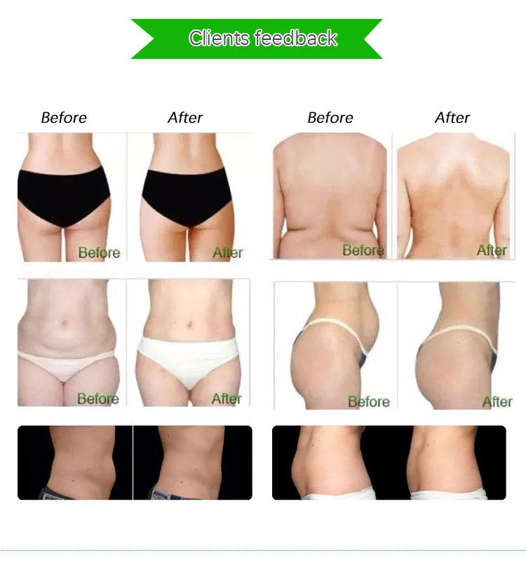 Sincoheren Kuma shape Women shapers вакуумная кавитационная система косметологическое оборудование для похудения и