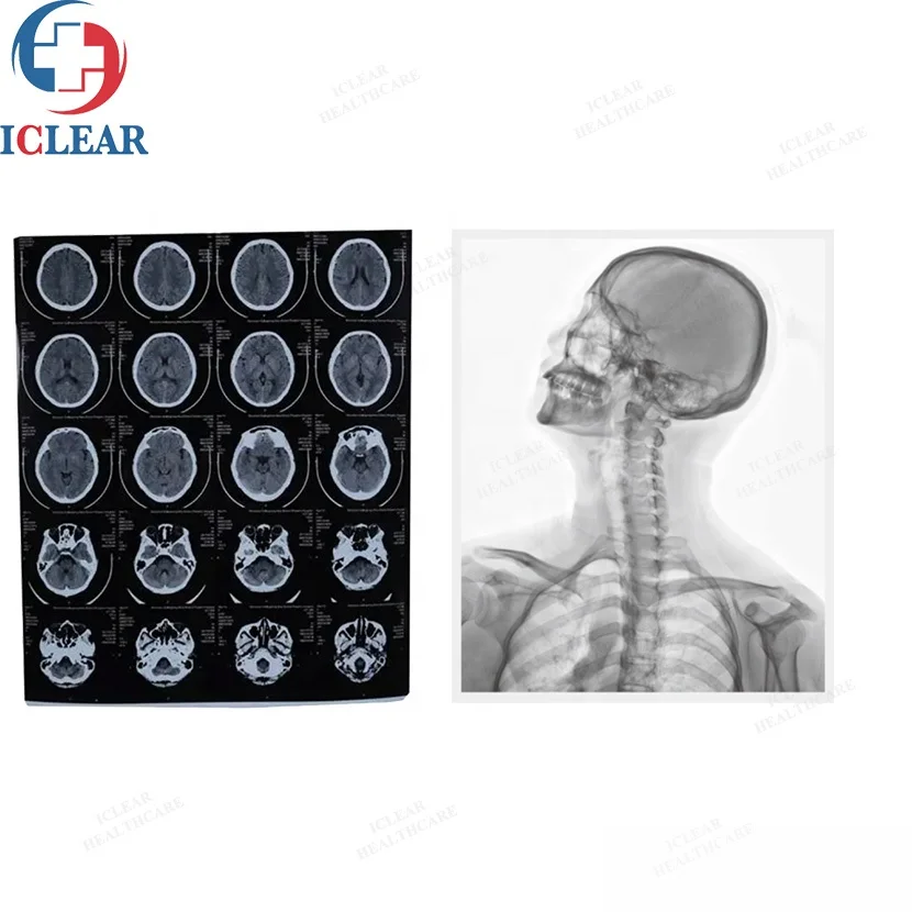 Hu.q Medical Thermo-graphic Film Processor Digital X-Ray Printer