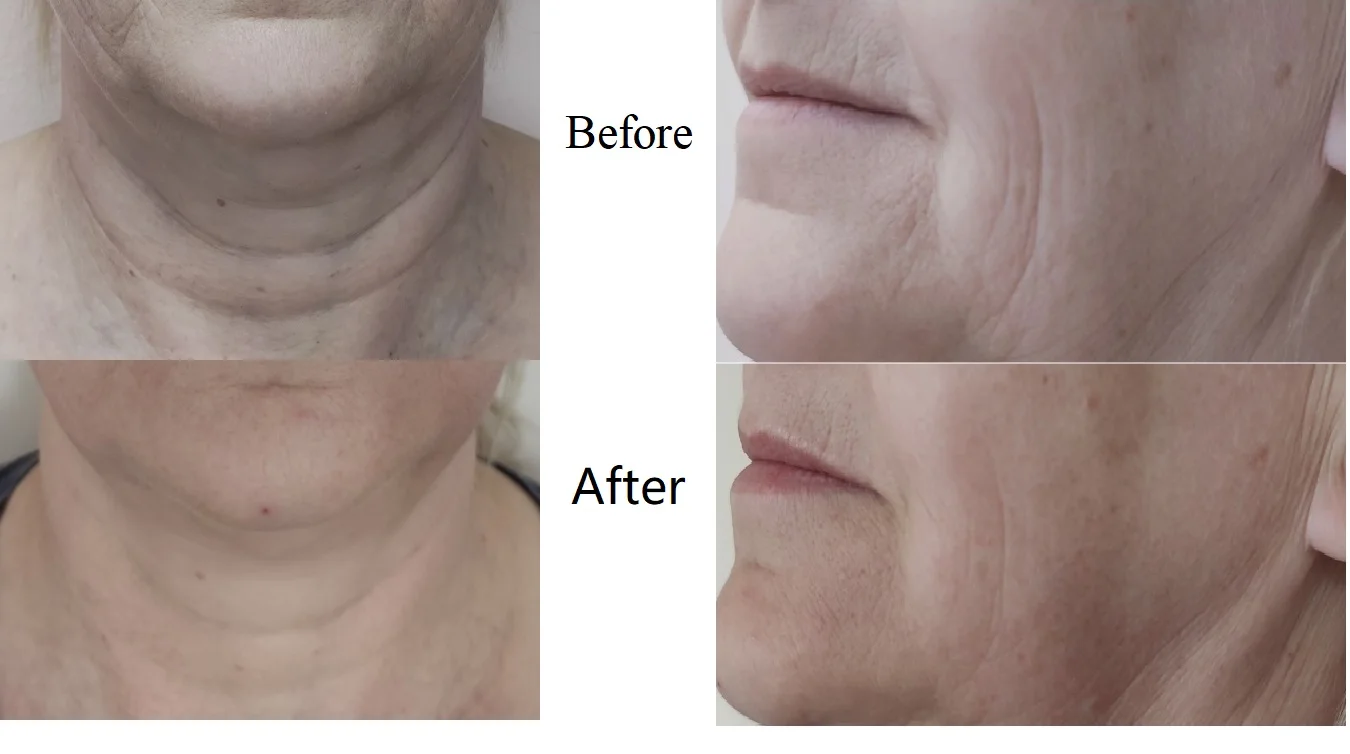 New BIO Electric Skin Lifting Machine Magic Glo-ve Electric Machine Au-8403