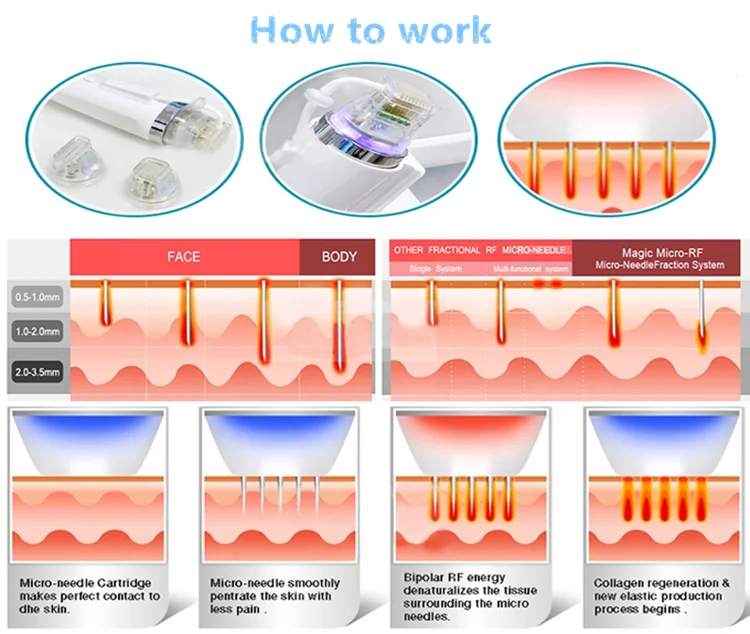 Fractional Rf Microneedle Machine/factory price of Rf Fractional machine