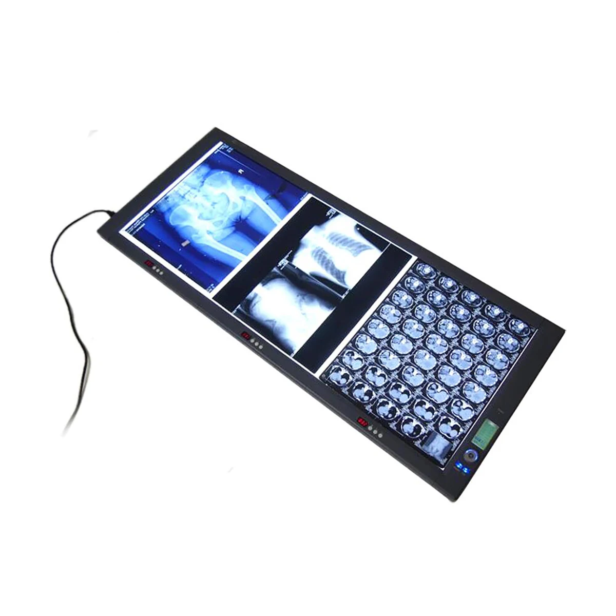 
Hot Sale Medical LED X-ray Film Viewer Triptych Viewing Light MSLZG3C 
