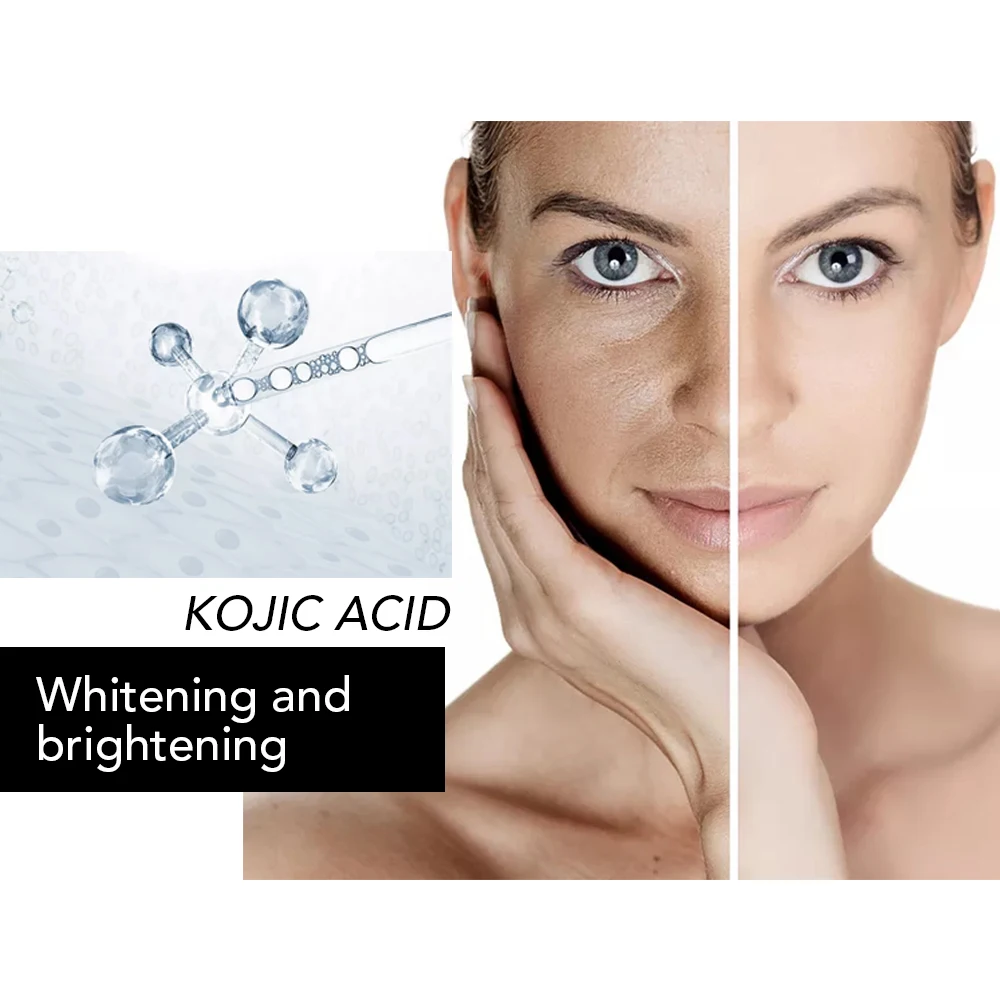 AILKE Kojic Acid baby Skin lightening acne soap with Rice wine extracted handmade coconut oil soaps for oil skin