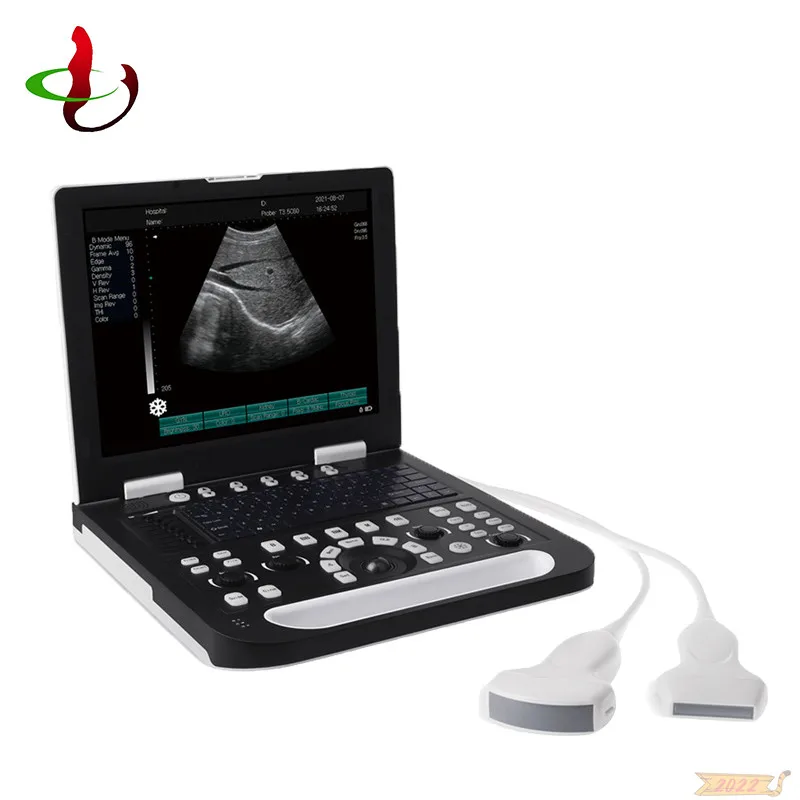 2022 Cheapest Portable  B/2B/4B/M 3D 4D Diagnostic Ultrasound Machine With Probe