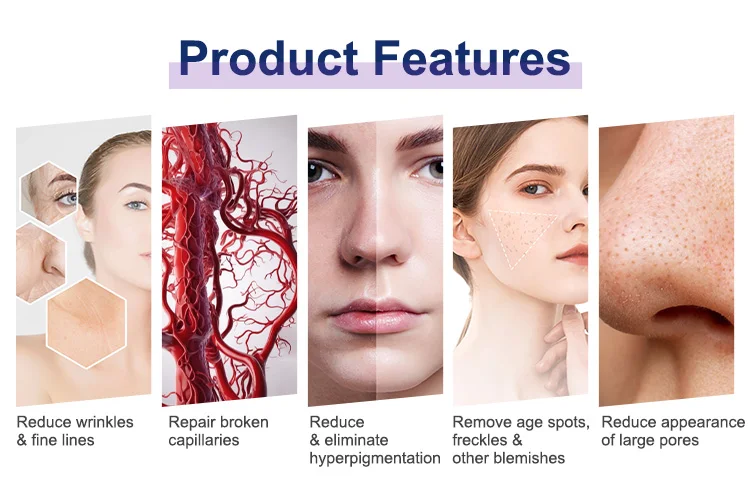 Profesional 50 Million Shots 808nm/755+808+1064nm Diode Laser Hair Removal Semiconductor Laser for Beauty Salon Center