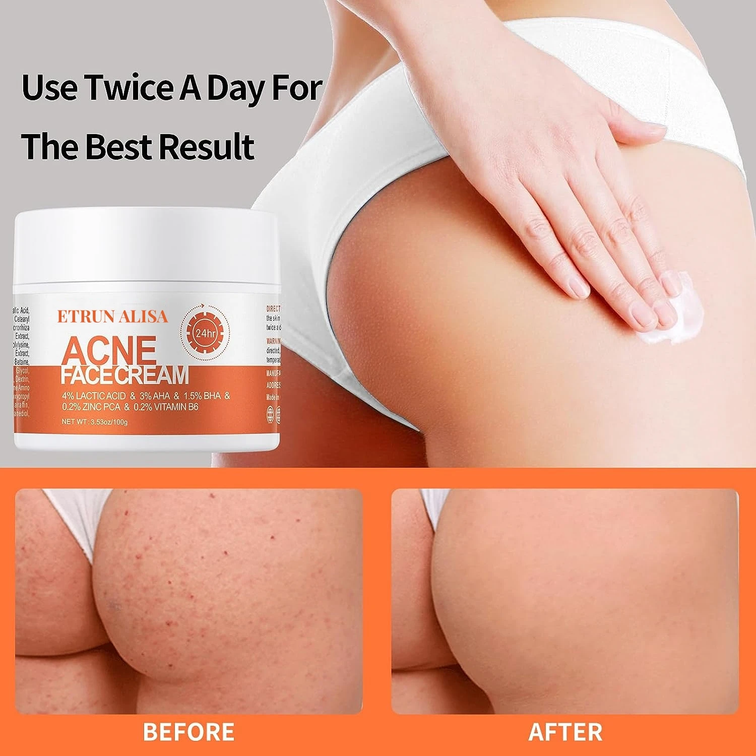 Натуральный веганский крем от акне с салициловой кислотой