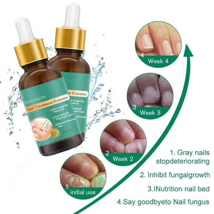 OEM Anti Fungal Treatment Finger Gel Beauty Care Nail