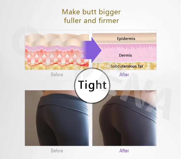 
2020 Hot sale OTVENA buttocks and butt enlargement cream hip enlargement cream 
