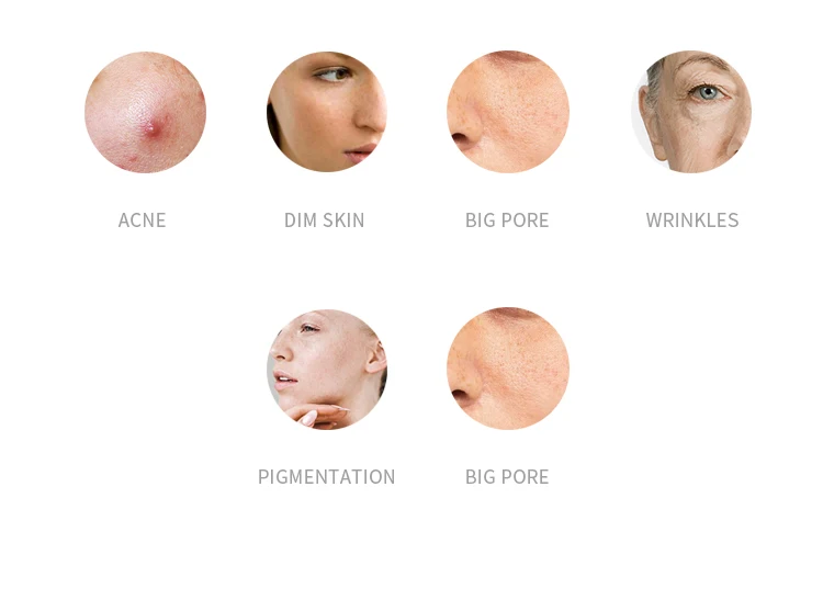 facial skin tightening