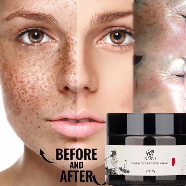 Private Label Face Care Bleaching Lighten Spots Quick Pimple Whitening Freckle Remove Chloasma Acne Dark Pigment Face Cream