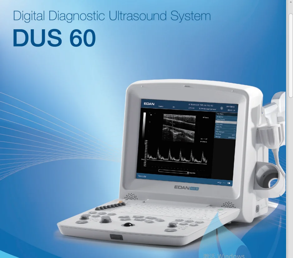 Edan DUS 60 Veterinary Ultrasound Scan Machine