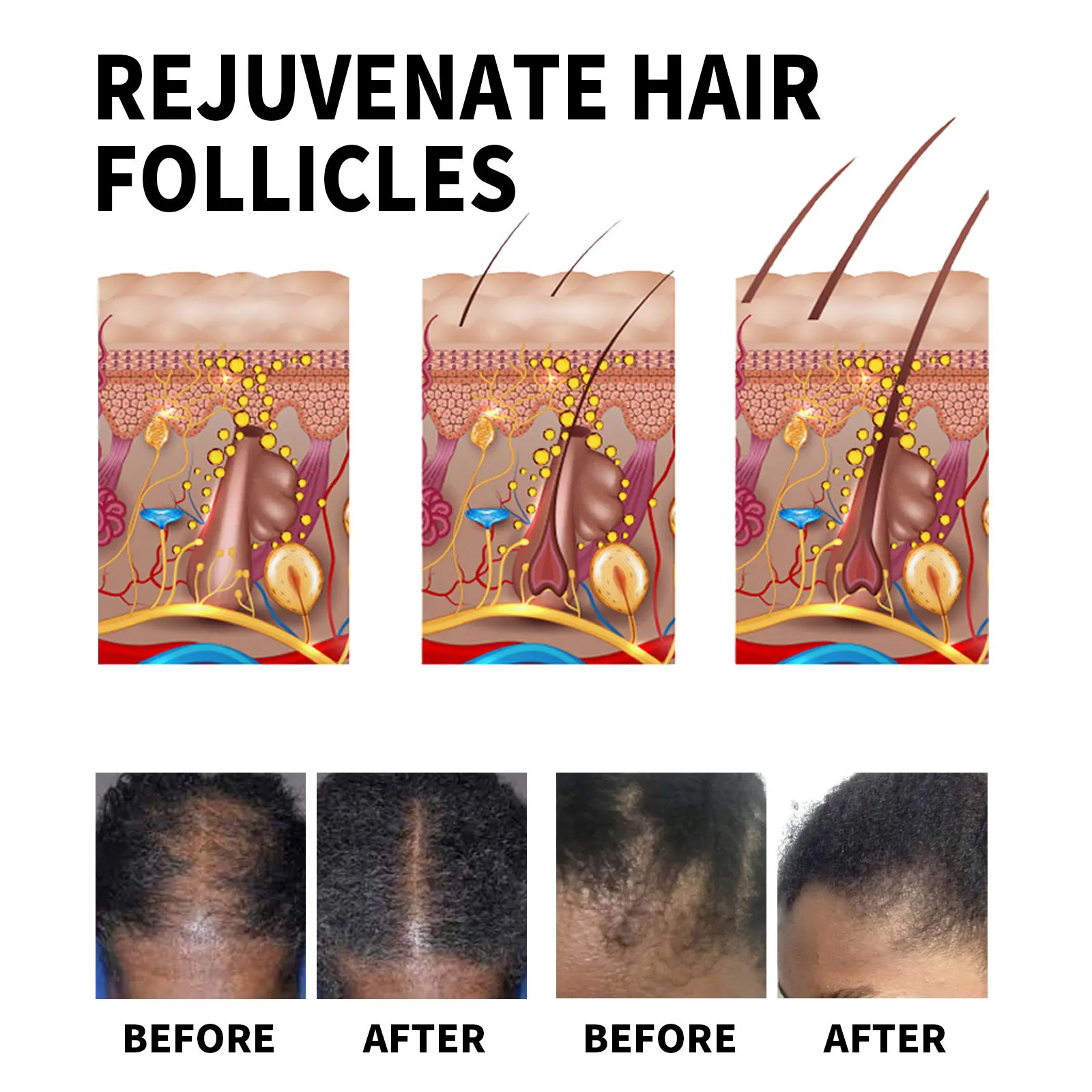 private label black women hair care treatment strengthening rosemary essential oil organic rosemary oil hair growth
