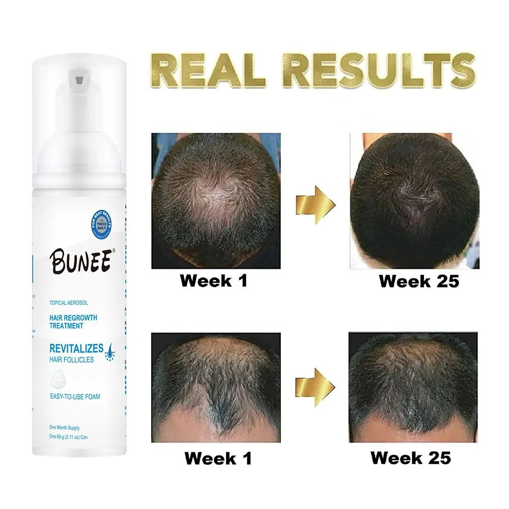 60ml private label Topical solution Collagen biotin bald hair growth oil foam