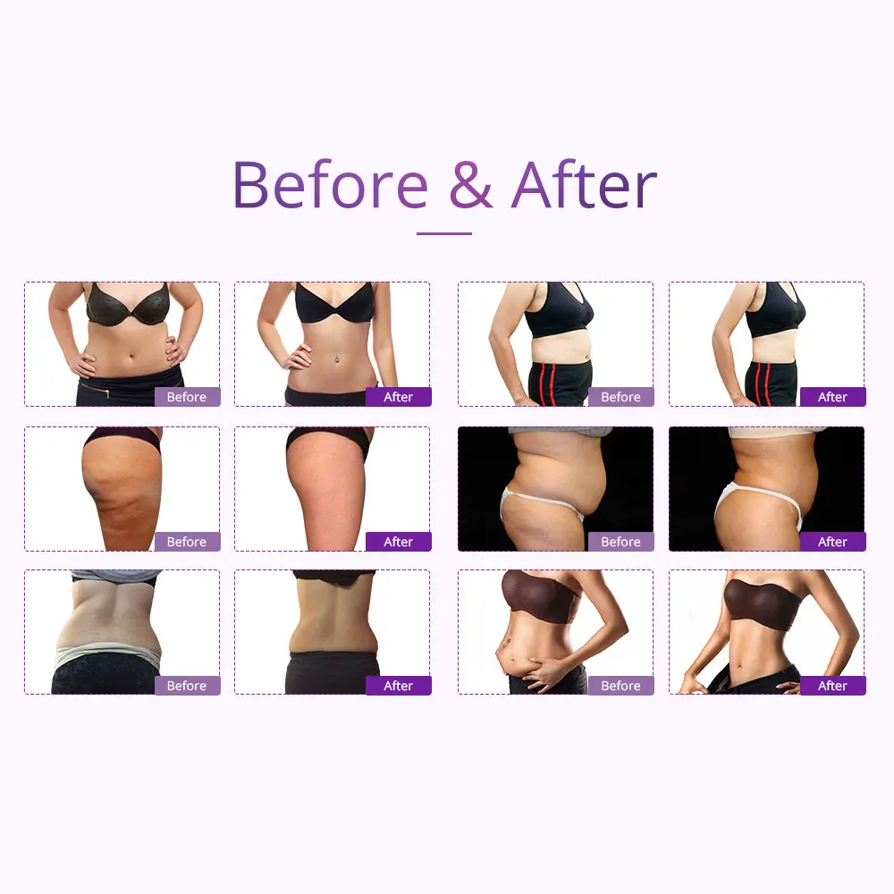40K Cavisation Vacuum 3D RF Photon Micro Current Face & Body Slimming 7 in 1 Cavisation Machine