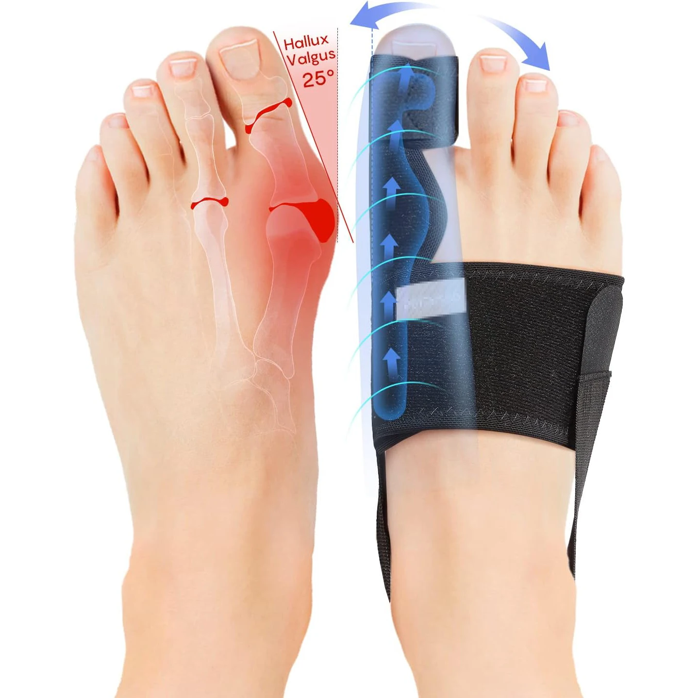 Ортопедический корректор для женщин и мужчин