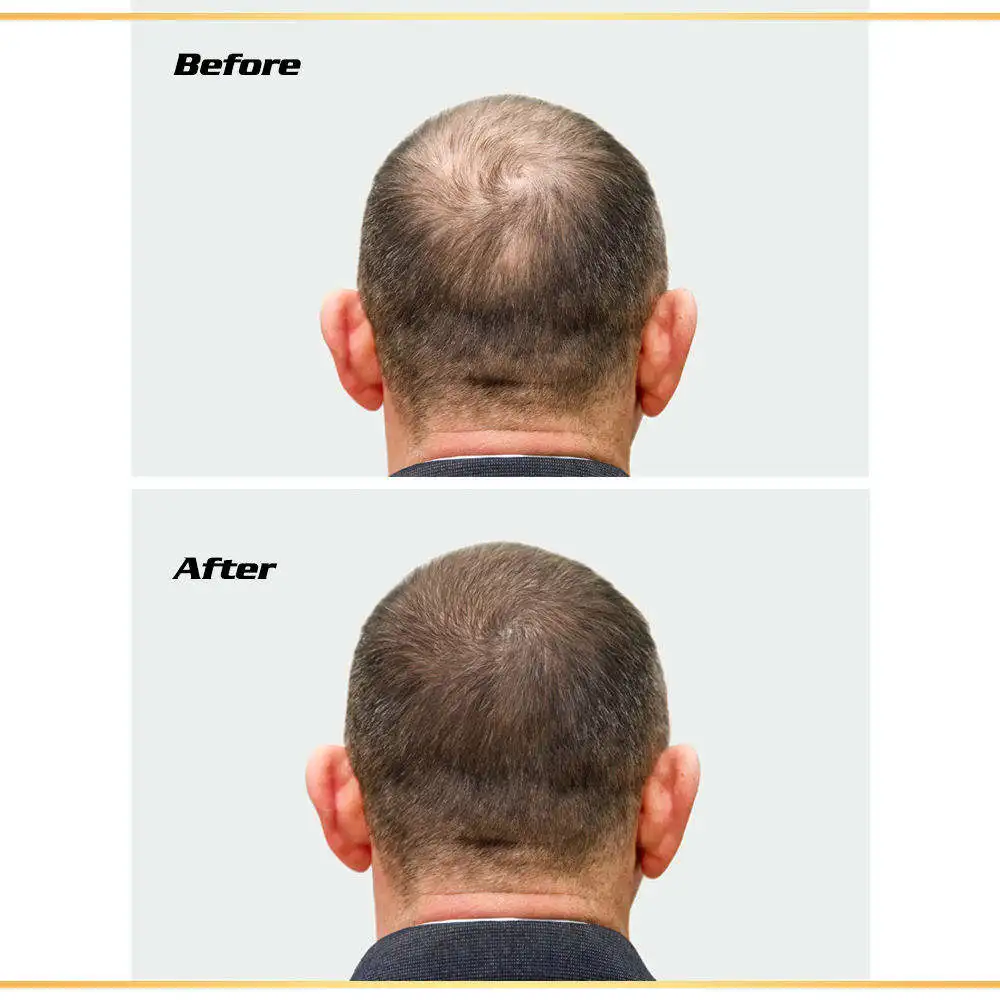 Best Hair Growth Products For Black Men Biotin Fast Hair Growth Oil Best Hair Growth Products For Black Men