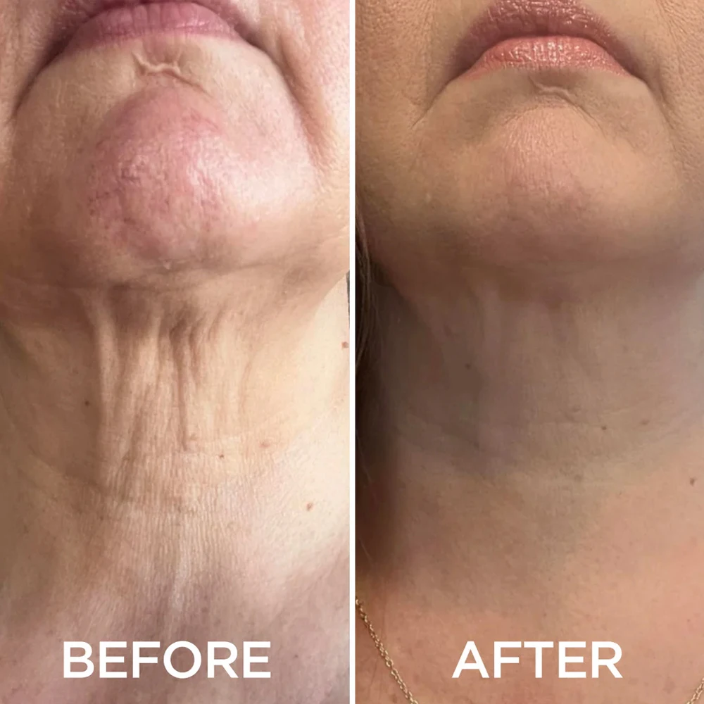 Private Label Cosmetics Beauty Women Breast Chest Neck Care Product Firm Lifting Tightening Fine Lines Neck Serum Cream Mask Set