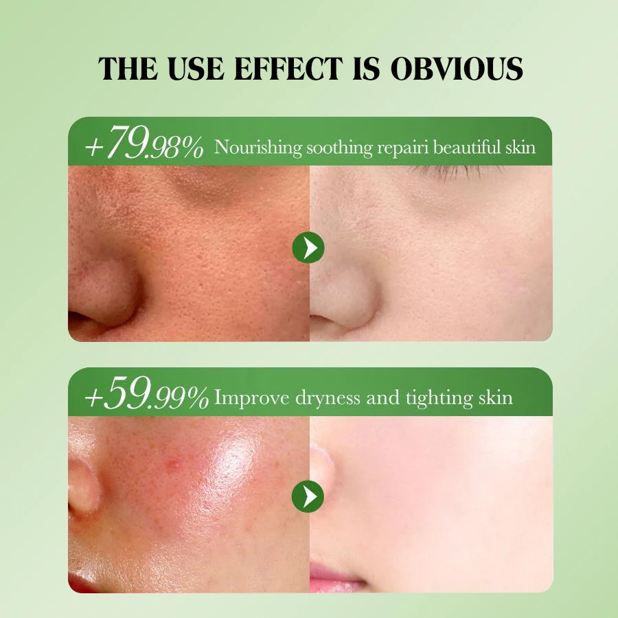 Factory Direct Selling Dear She Natural Plants Soothing Aloe Vera Facial Gel Cream Smoothing Moisturizing Face Skin Care