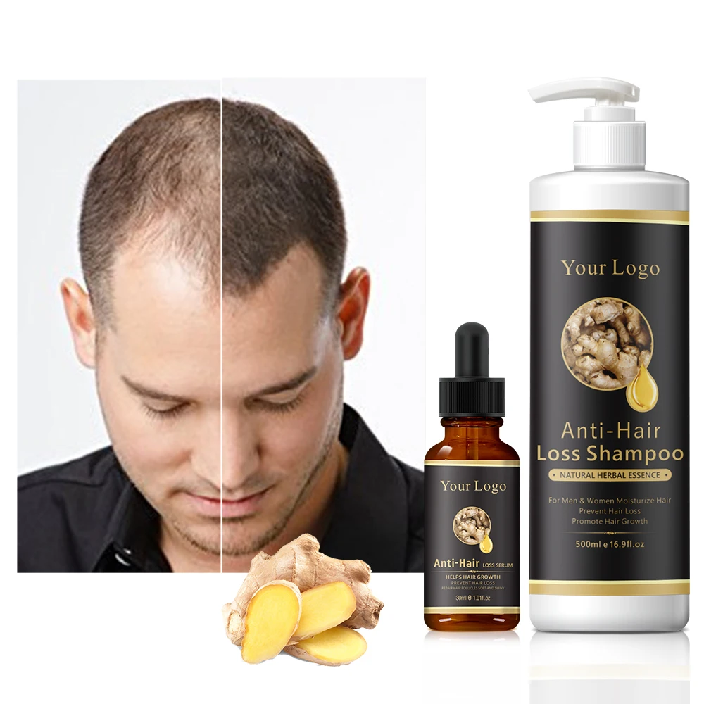 Custom Logo Hair Loss Shampoo Repairing Treatment Fast Anti Loss Hair Growth Shampoo