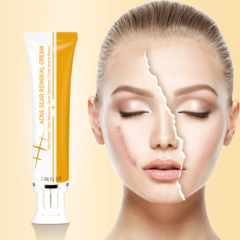 Private Label Pimples Stretch Marks Remove Face Gel Tummy Tuck Tightening Stretch Mark Removal Cream Acne Scar Removal Cream