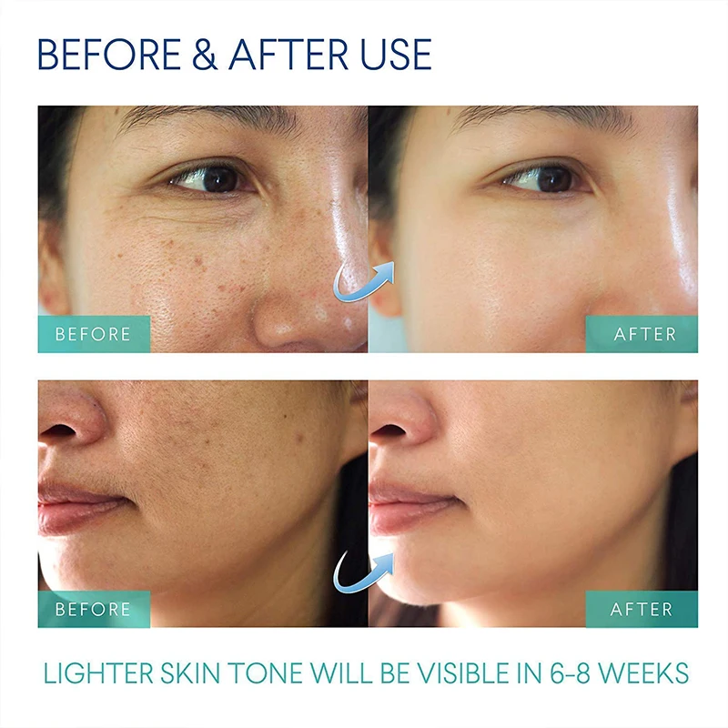 Ingrown Loss Treatment Dark Spot Corrector After Shave Repair Serum