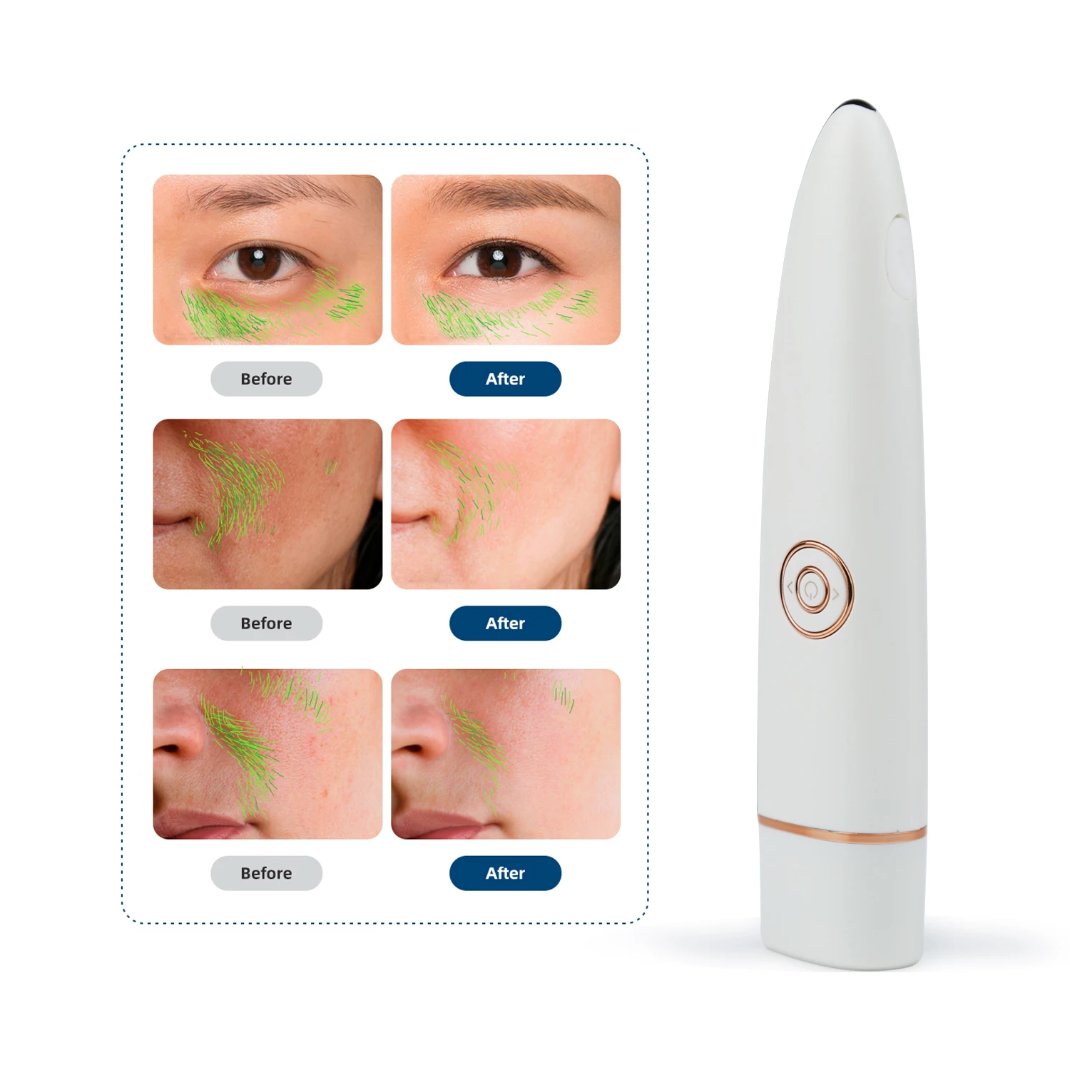 Global Free Samples Handheld Ionic Eye Care Beauty Device High Frequency RF Eye Beauty Device for Sensitive Skin