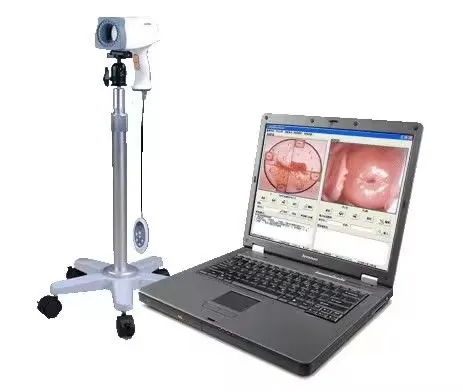 Kernel KN 2200 Full digital video colposcope machine Portable Gynecology Colposcopy System