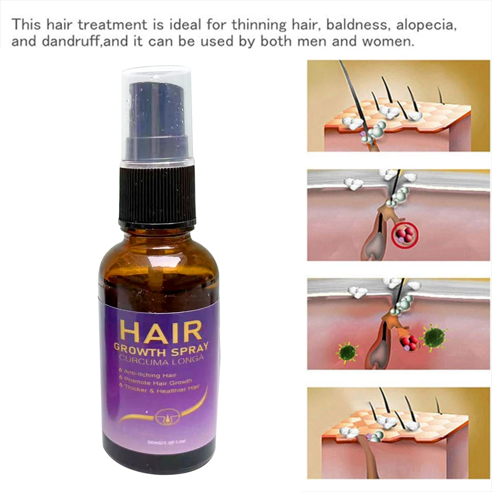 New Ginger Hair Care Growth Serum Hair Loss Treatment Spray 7 Days Effective Germinal Hair Growth Essential Oil