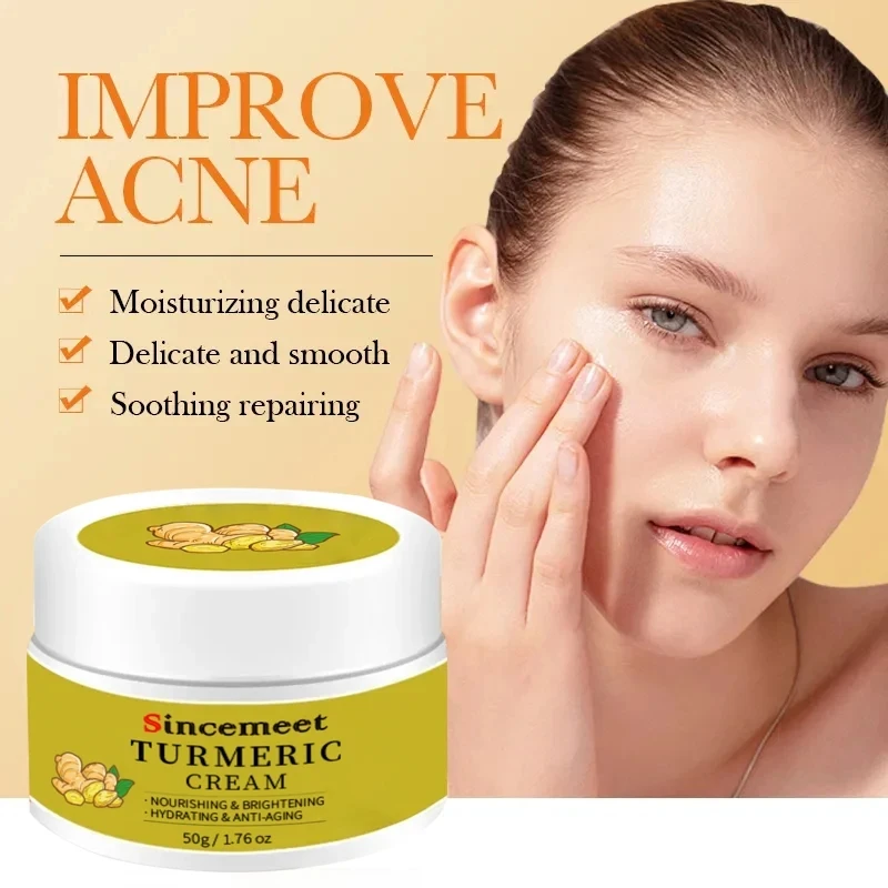 OEM Face Cream Care Removing Dark Spots Acne Treatment Anti Acne Face Vitamin C Cream Turmeric Cream