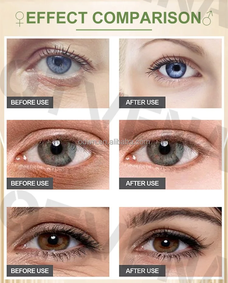 OTVENA Wholesale Low Moq Multi Action Anti Aging Eye Cream for Dry Sensitive Skin First Aid Beauty Eye Cream