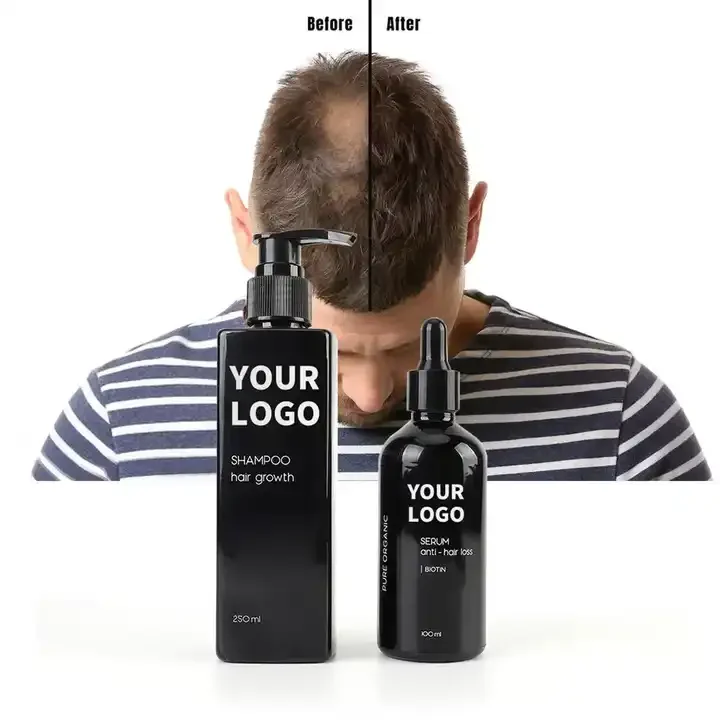 Supplier Wholesale Oil Control Anti Loss Hair Natural Regrowth Treatment Scalp Elixirs Hair Growth Oil Serum shampoo kits