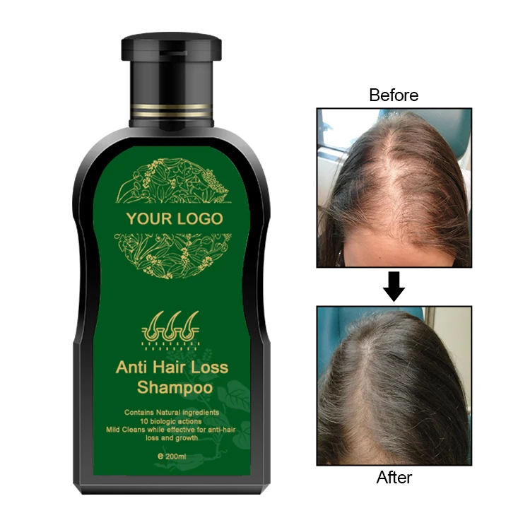  Шампунь для выпадения волос с логотипом на заказ восстанавливающий шампунь быстрой защиты от