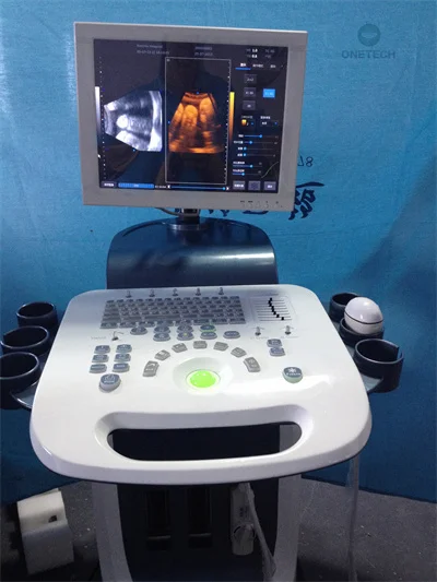 TC15 Mobile Color Doppler Digital Ultrasound 3d 4d Mult Probe Trolly Ultrasound Scanner Echo Ultrasound Machine For Pregnancy