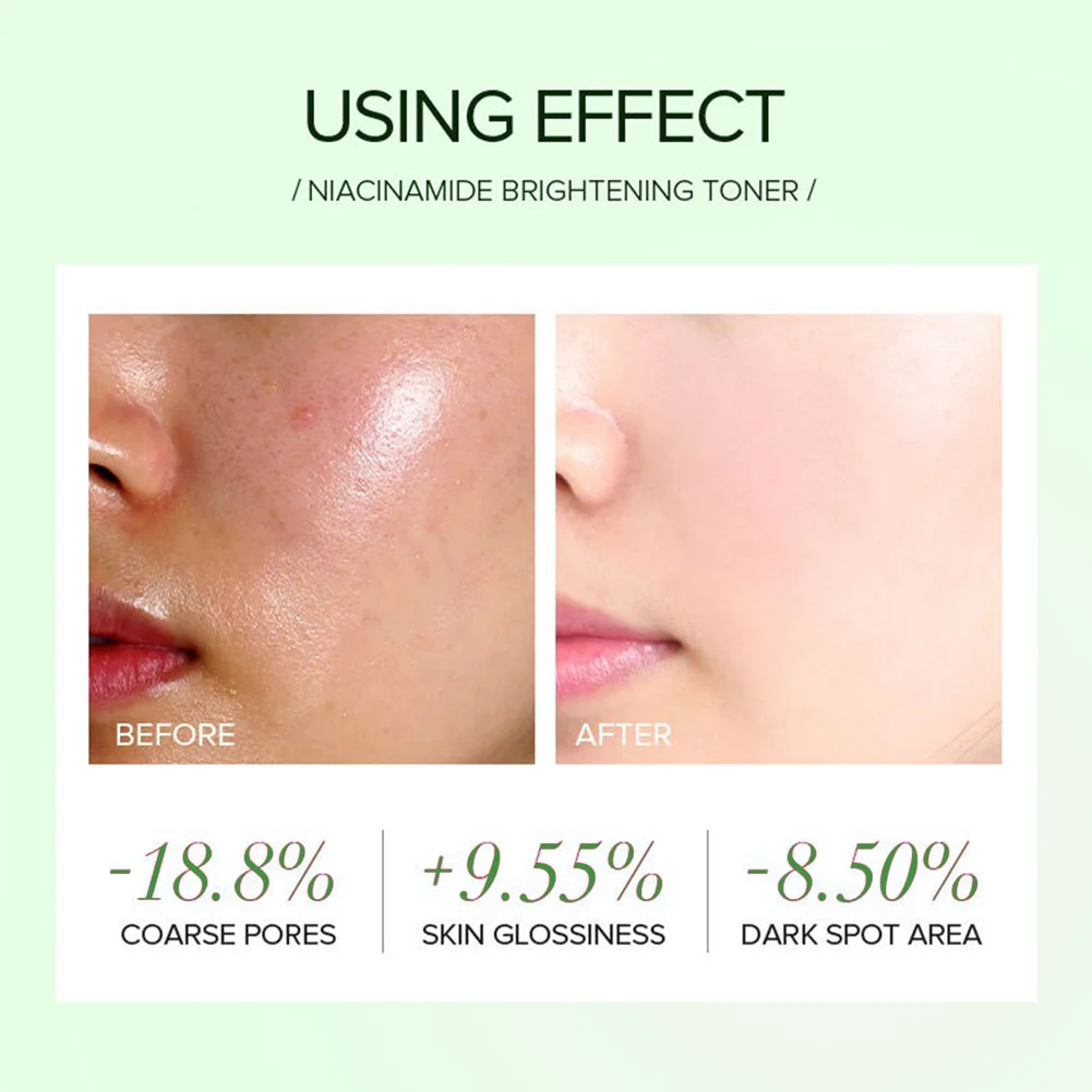 Private Label Glass Skin Moisturizer Hydrating Niacinamide Antioxidant Intensive Moisturizing Best Face Cream For Fair Skin