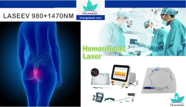 New Design 980NM Anal Piles Fistula Fissure And Pilonidal Sinus Laser External Hemorrhoid Treatment