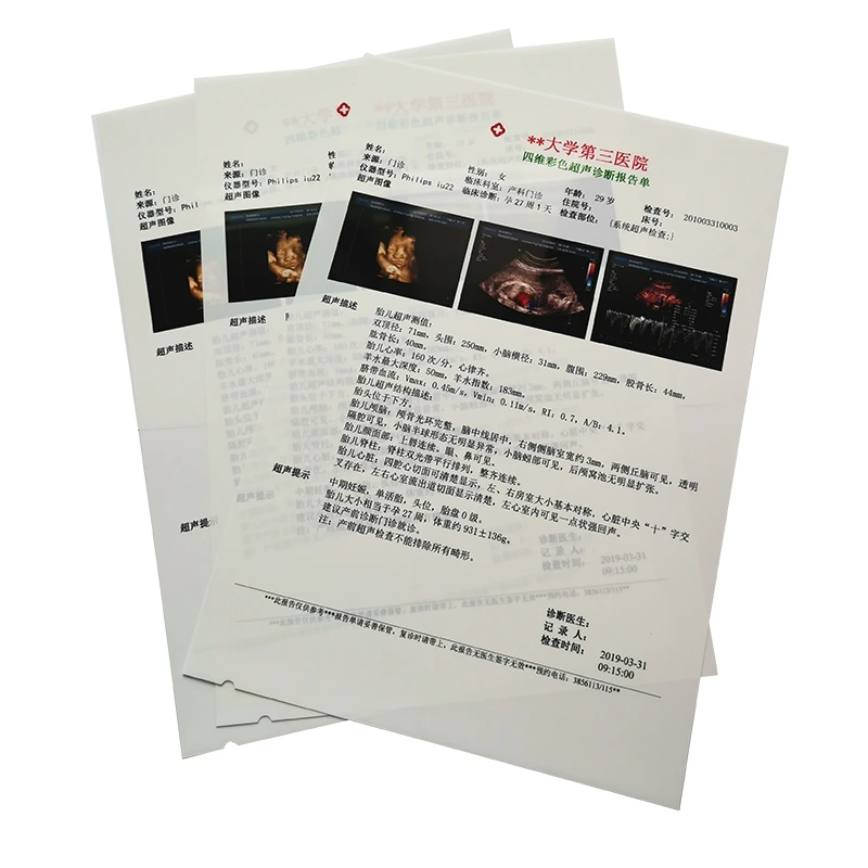 Laser printing pet film double sided print for advertisement digital print silk screen offset