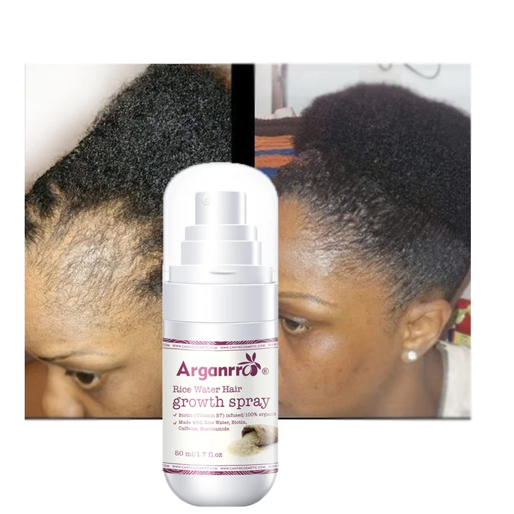 Nice Samples rice water extreme growth fast biotin hair growth serum spray for broken edge and hair