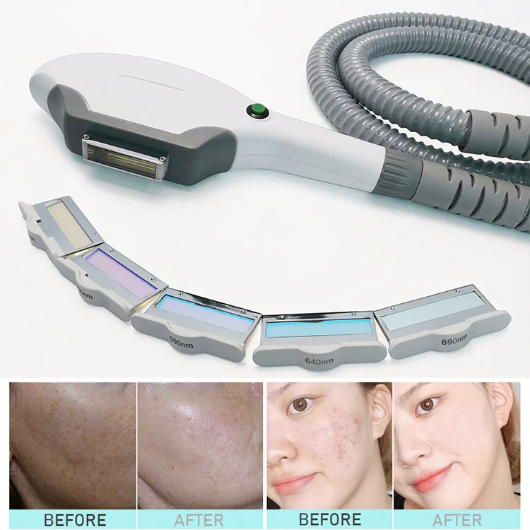 Intelligent diode laser with screen in the handle TEC cooling+ IPL skin rejuvenation 2 in 1 machine