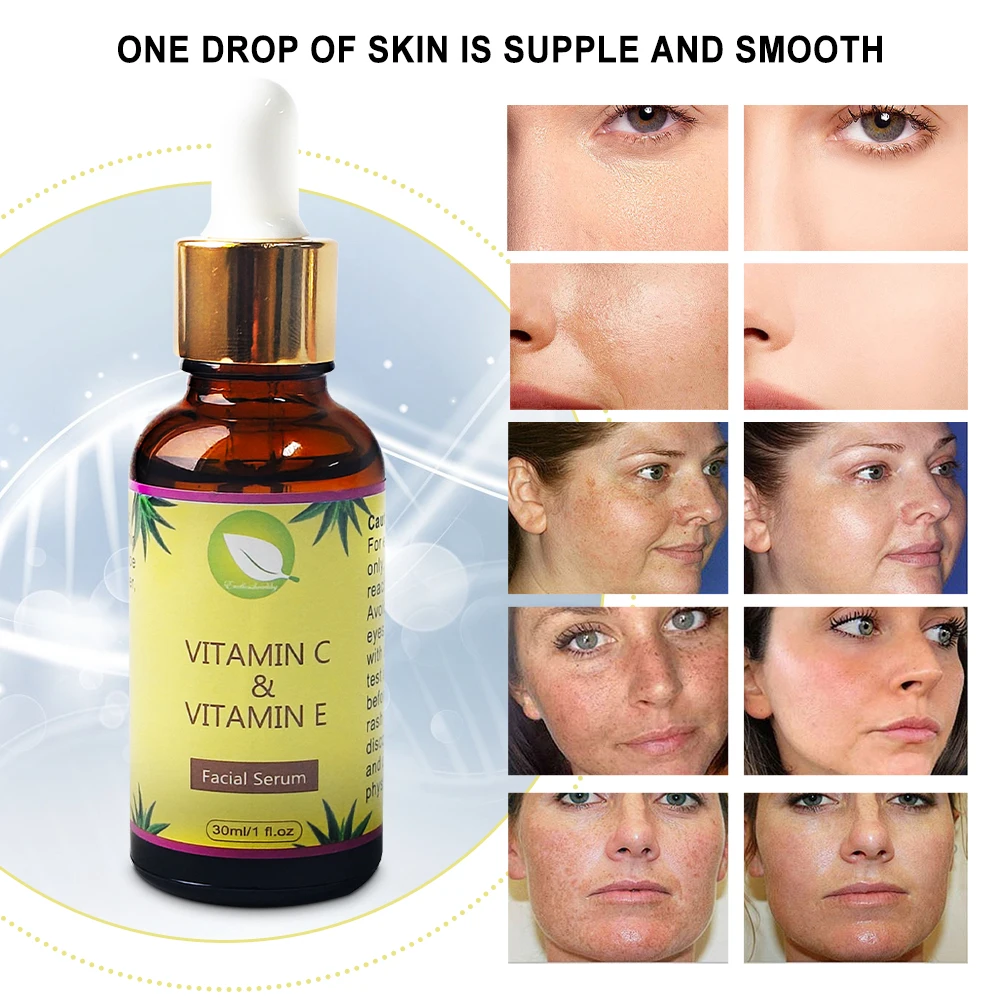 Dark Spot Removal Serum Wholesald Fast Whitening Moisturizing Face Serum Anti Wrinkle Skincare Anti Aging Serum