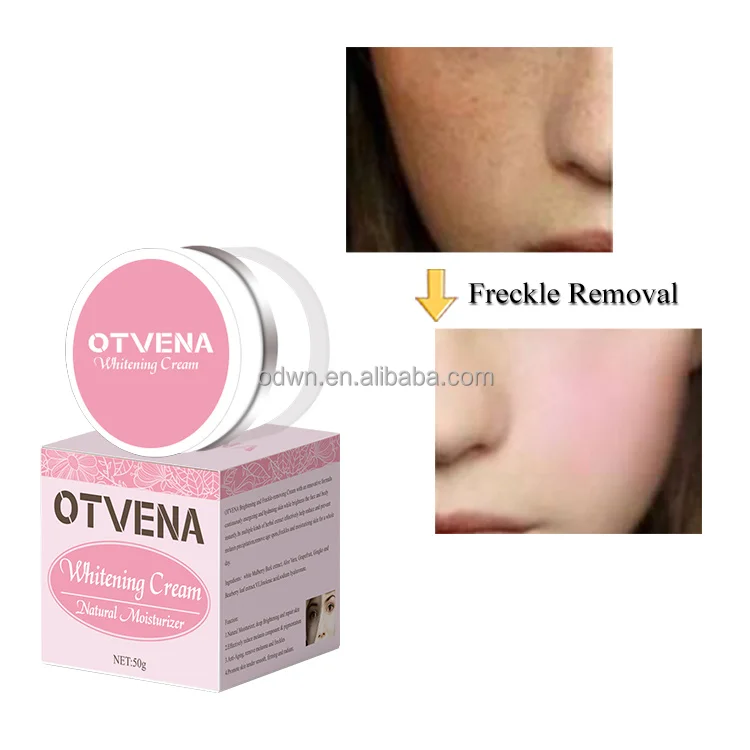 OTVENA Aloe Vera Moisturizer lightening cream skin whitening cream